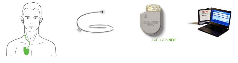 fda barostim neo