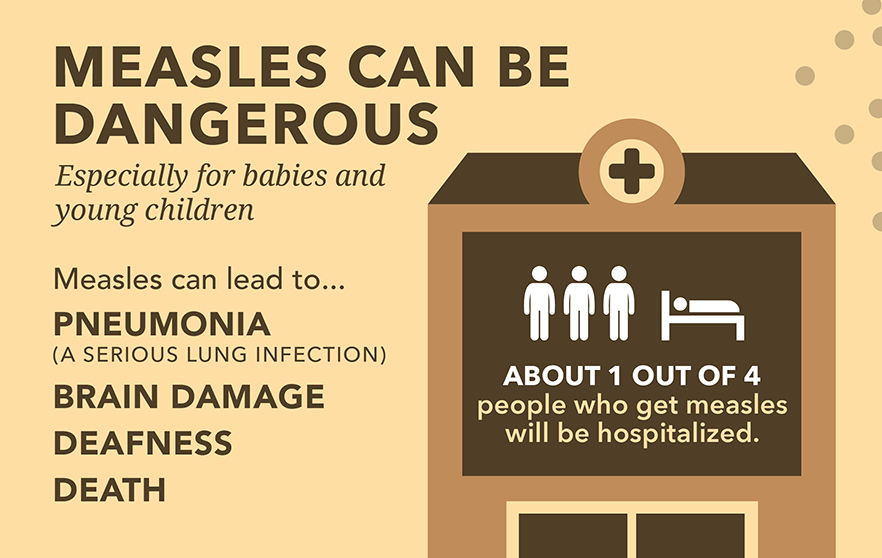 measles