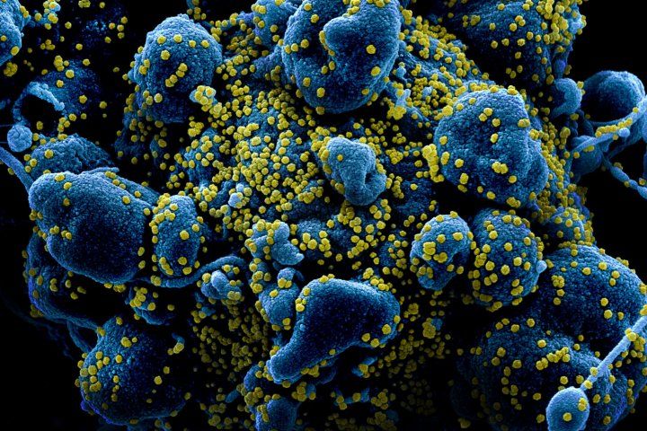 Coronavirus infected cell SEM