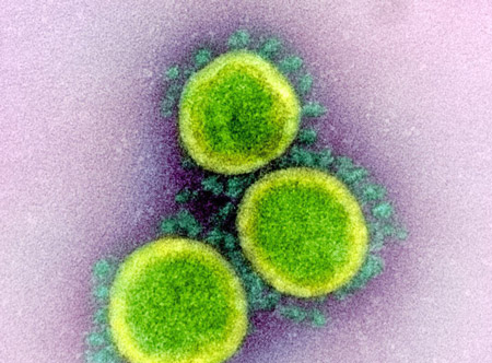 COVID electron micrograph NIH