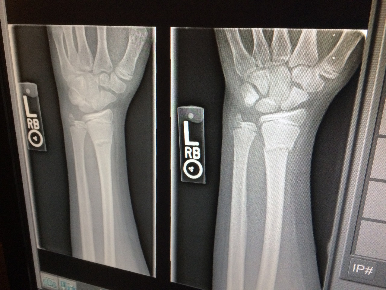 x ray 1273382 1280