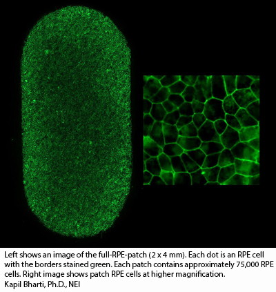 NIH 20220831 nei patch hole