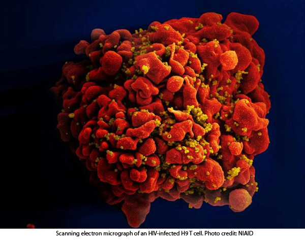 20220314 hiv