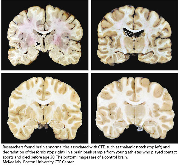 NIH 20230828 cte comparison cross sections