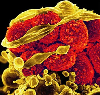 NIH 20240419 mrsa