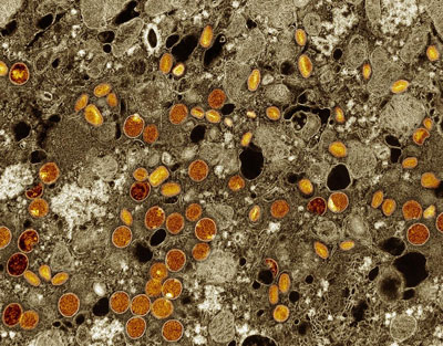 NIH 20240814 mpox virus particles