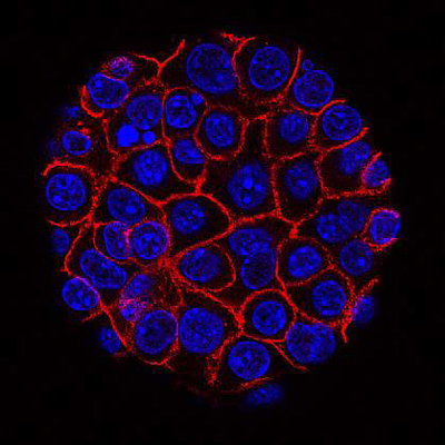 NIH 2024082 pancreatic cancer