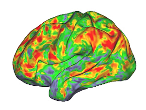 NIH psilocybin2