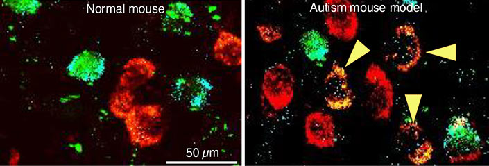 Spitzer NeuroSwitching