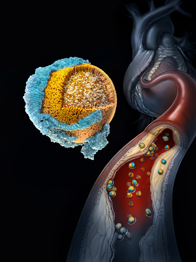 NIH cholesterol