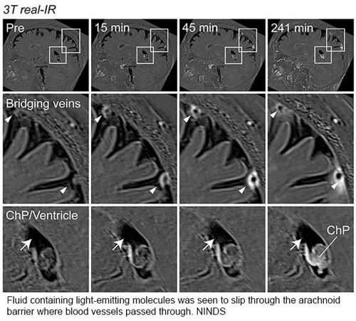 NIH MRI 20240207