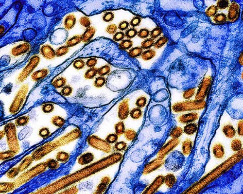 NIH 20240708 h5n1 virus