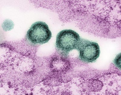 NIH 20240723 hiv preg