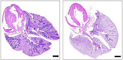 NIH 20240530 lung