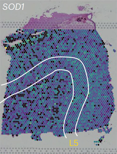 NIH 20240621 eggan als
