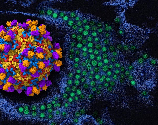 NIH 20240627 enterovirus