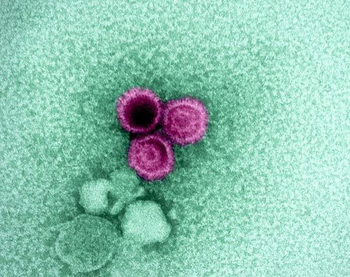 NIH 20230412 epstein barr virus