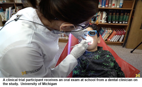 NIH 20240308 tooth decay500