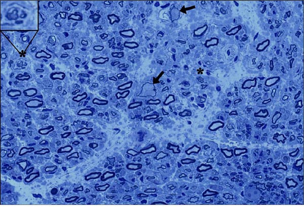 NIH 20240320 nerve regeneration600