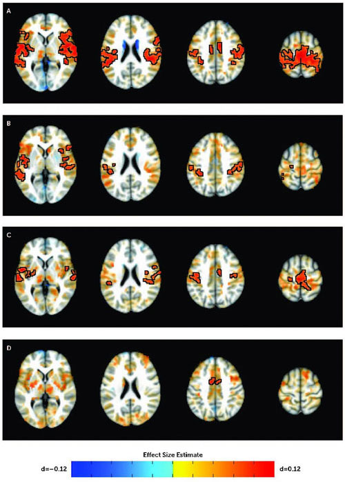 NIH subcortico cortical 