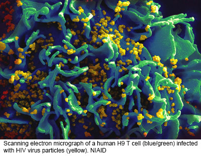 NIH 20240305 hiv