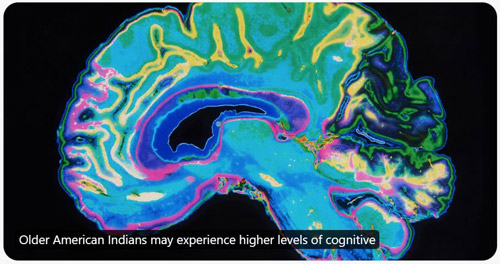 NIH 20240515 stock brain