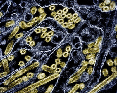 NIH 20240521 bird flu