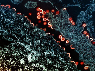 NIH 20240530 hiv