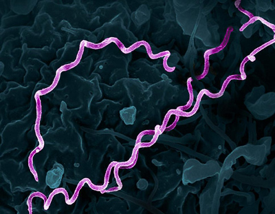 NIH 20240910 syphilis