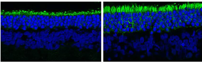 NIH 20250415 rod photoreceptors
