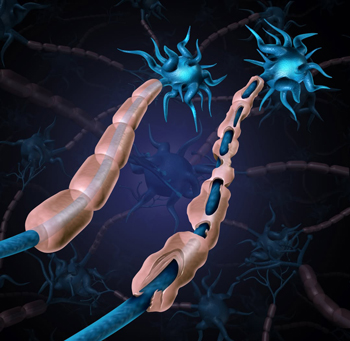 NIH multiple sclerosis