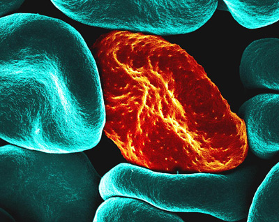 NIH 20250103 malaria