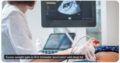 NIH fetal