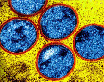 NIH 20250312 immature mpox virus 350