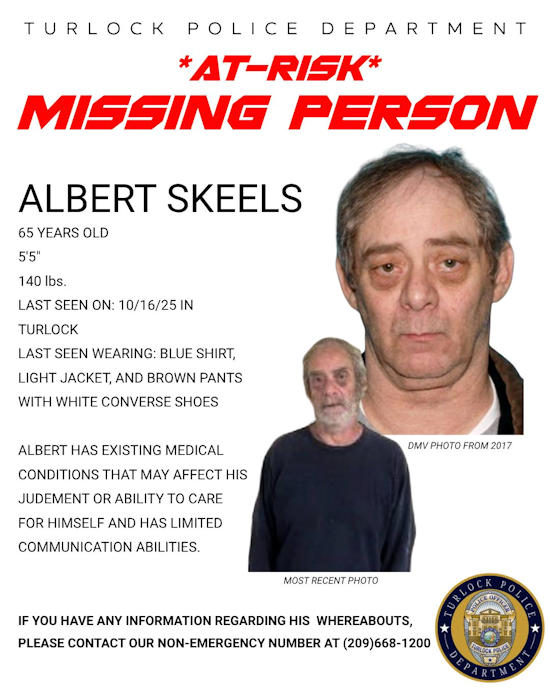 TPD missing Skeels