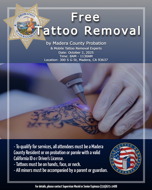 MCP tattoo