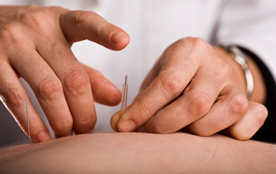 NIH acupuncture