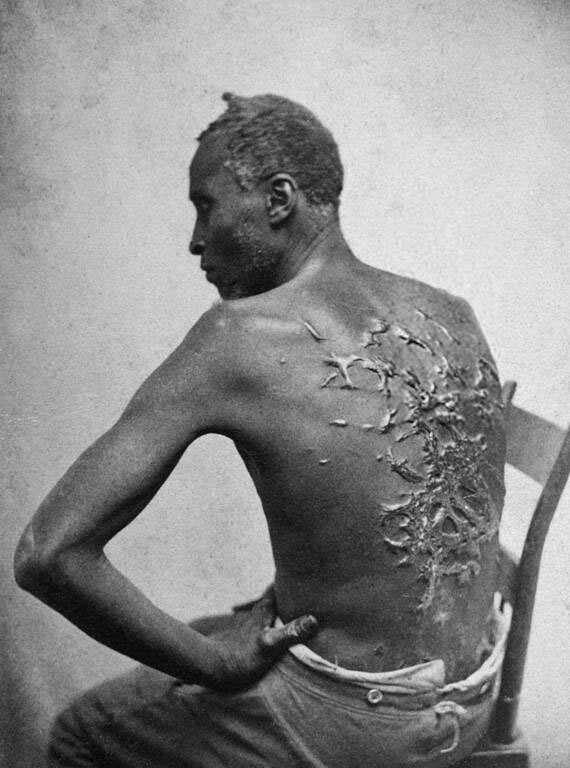 npca917 1863 photograph Scourged Back McPherson and Oliver circa 1863