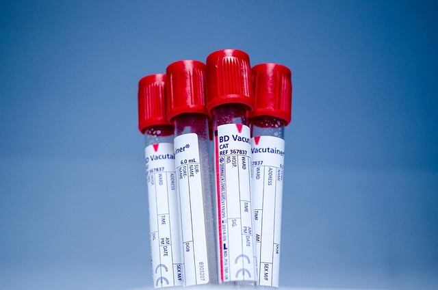 blood vials publicdomainpictures donate 315278 640
