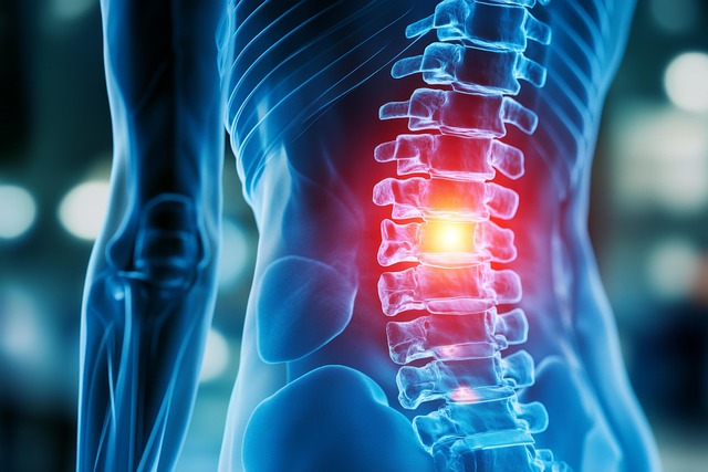 backpain herniated disc 8941869 640