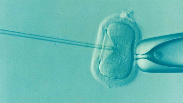 ivf 1514174 640