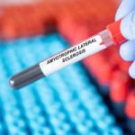 NIH Reports New Blood-Based Biomarkers Predict When ALS Symptoms Will Emerge