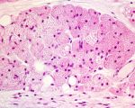 NIH Reports a Blood-Pressure Drug May Activate Health-Promoting Brown Fat