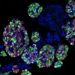 NIH-Funded Study Maps Human Pancreatic Islet Cells, Offering New Clues to Diabetes Risk