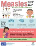 Fresno, Madera, and Merced Counties in Collaboration with the California Department of Public Health (CDPH) are Actively Monitoring Agricultural Workers Exposed to Measles in Arizona