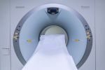 Should Lowest-Risk Prostate ‘Cancer’ Still Be Called Cancer? UCLA-led Study Suggests Changing The Name Could Save Lives
